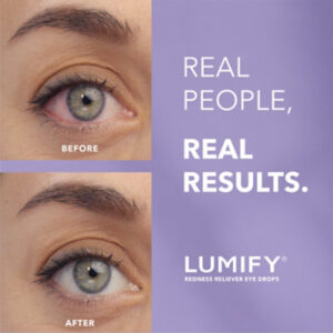 LUMIFY Redness Reliever Eye Drops Brimonidine Tartrate Ophthalmic Solution 0.025% - 0.25 Fl. Oz.